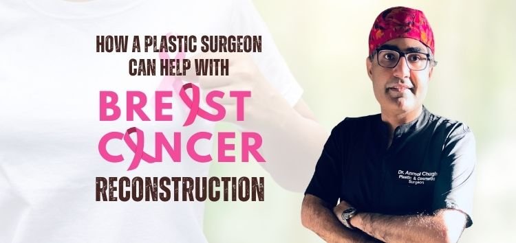 Breast Reconstruction Surgery